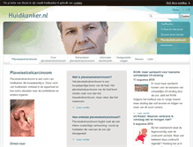 Tablet Screenshot of plaveiselcelcarcinoom.huidkanker.nl